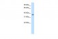 ZFP36 antibody - N-terminal region